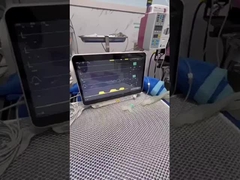 Monitorização indolor Alertas personalizáveis baseadas em assinatura do pulso oxímetro